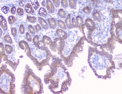 Beta-Catenin Antibody Mouse Small Intestine Tissue IHC. Immunohistochemistry analysis of FFPE mouse small intestine tissue using Beta-Catenin antibody shows strong membranous staining along epithelial cell borders lining the villi and crypts, consistent with CTNNB1 / Catenin beta-1 localization at adherens junctions, with mild cytoplasmic signal in enterocytes. Intestinal architecture is clearly preserved, and underlying stromal regions display comparatively low staining. Hematoxylin counterstain provides nuclear contrast and tissue context. HIER: steam FFPE sections in pH 6 citrate buffer for 20 min and allow to cool prior to testing.