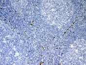 Immunohistochemical staining of human tonsil tissue using IL-33 antibody. Staining was performed with an HRP-conjugated secondary antibody and DAB substrate, with hematoxylin counterstaining. Staining is observed in scattered cells within lymphoid regions. Required HIER: steam section in pH6 citrate buffer for 20 min and allow to cool prior to testing.
