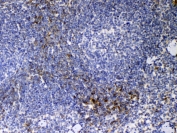 Immunohistochemistry analysis of Cd14 antibody in mouse spleen tissue. Formalin-fixed, paraffin-embedded mouse spleen tissue was stained using Cd14 antibody at a concentration of 1 ug per mL. Heat-induced epitope retrieval was performed by steaming tissue sections in citrate buffer, pH 6.0, for 20 minutes, followed by cooling prior to antibody incubation. Brown chromogenic signal is observed in scattered immune cells within splenic red pulp and perifollicular regions, consistent with Cd14-positive myeloid cell populations, while the majority of lymphoid cells in white pulp areas show little to no staining. This staining pattern reflects myeloid lineage-associated expression of Cd14 in mouse spleen tissue.