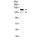 Flt3 Antibody Mouse Brain WB. Western blot testing of mouse brain lysate with Flt3 antibody at 0.5ug/ml. Predicted molecular weight: ~113 kDa (unmodified), ~130/160 kDa (glycosylated).