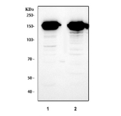 Flt3 Antibody Liver WB. Western blot testing of 1) rat liver and 2) mouse liver tissue lysate with Flt3 antibody at 0.5ug/ml. Predicted molecular weight: ~113 kDa (unmodified), ~130/160 kDa (glycosylated).
