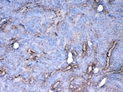 Galectin 1 Antibody Rat Kidney IHC. Immunohistochemical staining of FFPE rat kidney tissue using Galectin 1 antibody at 1 ug/ml demonstrates cytoplasmic and membranous HRP-DAB brown staining within renal tubular epithelial cells and associated kidney structures. The observed staining pattern is consistent with expression of Galectin-1 (LGALS1), a beta-galactoside-binding lectin involved in cell adhesion, immune regulation, extracellular matrix remodeling, tissue repair, and glycan-mediated signaling pathways. Positive immunoreactivity is primarily localized to tubular compartments, supporting the known role of Galectin-1 in renal physiology and cellular communication within the kidney microenvironment. HIER: steam section in pH6 citrate buffer for 20 min and allow to cool prior to testing.