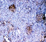 Galectin 1 Antibody Rat Kidney IHC. Immunohistochemistry was performed on FFPE rat kidney tissue using Galectin 1 Antibody. Heat-induced epitope retrieval was performed in pH 8 EDTA buffer prior to incubation with the primary antibody at 2 ug/ml. Bound antibody was visualized using an HRP-conjugated goat anti-rabbit IgG secondary antibody with DAB chromogen. Predominantly cytoplasmic staining is observed in renal glomeruli and selected tubular epithelial cells, consistent with the reported distribution of Galectin 1 in kidney tissue. These results demonstrate that this Galectin 1 Antibody is suitable for immunohistochemical detection of Galectin 1 in formalin-fixed, paraffin-embedded rat kidney tissue.