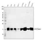 Galectin 1 Antibody Human, Rat and Mouse WB. Western blot analysis was performed using Galectin 1 Antibody. Lane 1: human HeLa whole cell lysate; lane 2: human A549 whole cell lysate; lane 3: human A375 whole cell lysate; lane 4: human MCF-7 whole cell lysate; lane 5: rat kidney tissue lysate; lane 6: rat PC-12 whole cell lysate; lane 7: mouse kidney tissue lysate; lane 8: mouse NIH/3T3 whole cell lysate. Proteins were separated on a 13% SDS-PAGE gel, transferred to a nitrocellulose membrane, and incubated with the primary antibody at 0.5 ug/ml overnight at 4Â°C. A specific immunoreactive band is detected at approximately 15 kDa in all tested samples, consistent with the expected molecular weight of Galectin 1. These results demonstrate that this Galectin 1 Antibody is suitable for Western blot detection of Galectin 1 across human, rat, and mouse tissues and cell lines.