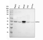 GATA4 Antibody Human and Rat WB. Western blot analysis of GATA4 Antibody using lysates from lane 1: human HepG2 cells, lane 2: human PC-3 cells, lane 3: human HUH7 cells, lane 4: human 293T cells and lane 5: rat liver tissue. A prominent band is detected at approximately 54 kDa in all samples, which is commonly observed for GATA4 despite a predicted molecular weight of approximately 45 kDa, likely reflecting post-translational modification. These results demonstrate cross-species detection of endogenous GATA4 and support the use of GATA4 Antibody, a Cardiac Transcription Factor Antibody, for studies of transcriptional regulation, organ development and cardiovascular biology.