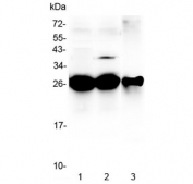 Western blot testing of 1) rat liver, 2) mouse liver and 3) mouse HEPA1-6 lysate with MBL2 antibody at 0.5ug/ml. Predicted molecular weight ~26 kDa.