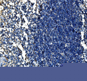 Immunohistochemical staining of FFPE human tonsil tissue with SCF antibody, HRP-secondary and DAB substrate. HIER: boil tissue sections in pH8 EDTA for 20 min and allow to cool before testing.
