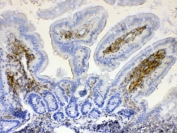 IHC testing of FFPE mouse intestine tissue with LYN antibody at 1ug/ml. Required HIER: steam section in pH6 citrate buffer for 20 min and allow to cool prior to testing.