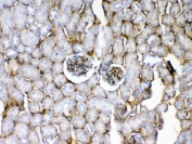 CD105 Antibody Mouse Kidney IHC. Immunohistochemistry analysis of FFPE mouse kidney tissue using CD105 Antibody demonstrates HRP-DAB brown membranous staining in endothelial cells lining renal vasculature, including vessels associated with glomerular and interstitial regions, consistent with Endoglin / CD105 expression as a vascular marker and supporting cross-species detection in mouse tissue, while surrounding tubular epithelial cells show minimal staining; nuclei are counterstained blue. HIER: steam tissue sections in pH 6 citrate buffer for 20 min and allow to cool prior to testing.
