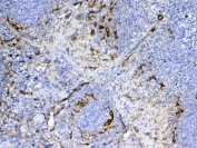 CD105 Antibody Mouse Spleen IHC. Immunohistochemistry analysis of FFPE mouse spleen tissue using CD105 Antibody demonstrates HRP-DAB brown membranous staining in endothelial cells associated with splenic vascular structures, including vessels within red pulp regions, consistent with Endoglin / CD105 expression as a vascular endothelial marker, supporting cross-species detection in lymphoid tissue; nuclei are counterstained blue. HIER: steam sections in pH 6 citrate buffer for 20 min and allow to cool prior to testing.