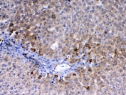 CD105 Antibody Rat Liver IHC. Immunohistochemistry analysis of FFPE rat liver tissue using CD105 Antibody demonstrates HRP-DAB brown membranous staining in endothelial cells outlining hepatic sinusoidal and vascular structures, consistent with Endoglin / CD105 expression in liver vasculature, supporting cross-species detection in rat tissue; nuclei are counterstained blue. HIER: steam sections in pH 6 citrate buffer for 20 min and allow to cool prior to testing.