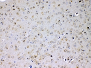 IL15RA Antibody Mouse Brain IHC. Immunohistochemical staining of FFPE mouse brain tissue using IL15RA Antibody at 1 ug/ml. HIER was performed in pH 6 citrate buffer. An HRP-conjugated secondary antibody with DAB substrate was used for detection. IL15RA Antibody, an Immune Cell Activation Receptor Antibody, demonstrates predominantly membranous and cytoplasmic staining of cells throughout the brain tissue, consistent with the expected localization of IL15RA.