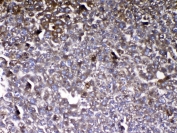 VDBP Antibody Mouse Liver IHC. Immunohistochemistry analysis of FFPE mouse liver tissue stained with VDBP antibody demonstrates diffuse granular cytoplasmic HRP-DAB brown staining throughout hepatocyte-associated cellular populations, consistent with the role of Vitamin D binding protein / VDBP as a major hepatic secretory and circulating transport protein involved in vitamin D metabolism and systemic endocrine homeostasis. The widespread staining profile aligns with the established liver-associated expression of this abundant serum carrier protein. Required HIER: steam tissue sections in pH 6 citrate buffer for 20 min and allow to cool prior to testing.