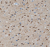 Immunohistochemistry analysis of SAP102/DLG3 expression in human brain tissue. Paraffin-embedded human brain sections were subjected to heat-mediated antigen retrieval in EDTA buffer (pH 8.0) and incubated with anti-SAP102/DLG3 antibody, followed by HRP-conjugated secondary antibody and DAB chromogen development. Brown staining is observed in neuronal cells, consistent with synapse-associated protein 102 localization, with hematoxylin nuclear counterstain (blue).