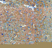 Immunohistochemistry analysis of SAP102/DLG3 expression in mouse brain tissue. Paraffin-embedded mouse brain sections were subjected to heat-mediated antigen retrieval in EDTA buffer (pH 8.0) and incubated with anti-SAP102/DLG3 antibody, followed by HRP-conjugated secondary antibody and DAB chromogen development. Brown immunoreactivity is observed in neuronal cells and surrounding neuropil, consistent with synapse-associated protein 102 distribution, with hematoxylin nuclear counterstain (blue).