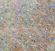 Immunohistochemistry analysis of SAP102/DLG3 expression in rat brain tissue. Paraffin-embedded rat brain sections were subjected to heat-mediated antigen retrieval in EDTA buffer (pH 8.0) and incubated with anti-SAP102/DLG3 antibody, followed by HRP-conjugated secondary antibody and DAB chromogen development. Brown staining is detected in neuronal cell bodies and processes, consistent with synapse-associated protein 102 localization, with hematoxylin nuclear counterstain (blue).