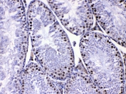 IHC testing of FFPE mouse testis tissue with MED8 antibody at 1ug/ml. Required HIER: steam section in pH6 citrate buffer for 20 min and allow to cool prior to testing.