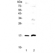 Epigen Antibody A431 and PC-12 Cell WB. Western blot analysis was performed using human A431 epithelial cell lysate in lane 1 and rat PC-12 cell lysate in lane 2. The membrane was incubated with Epigen antibody at 0.5 ug/ml. A distinct band was detected at approximately 17 kDa in both samples, matching the predicted molecular weight of the Epigen precursor protein. The results demonstrate recognition of endogenous Epigen in human and rat cell lysates. Epigen Antibody, an epithelial mitogen antibody, supports cross-species studies of EPGN expression, epithelial proliferation and EGFR ligand signaling.