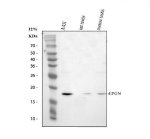Epigen Antibody Human Cell and Rodent Testis WB. Western blot analysis was performed under reducing conditions using 30 ug of lysate per lane. Lane 1: human A431 cells; Lane 2: rat testis tissue; Lane 3: mouse testis tissue. The membrane was incubated overnight at 4Â°C with rabbit anti-Epigen antibody at 0.5 ug/ml, followed by an HRP-conjugated goat anti-rabbit IgG secondary antibody and ECL detection. A specific band was observed at approximately 17 kDa in all three samples, matching the expected molecular weight of Epigen. Epigen Antibody, an epithelial mitogen antibody, supports analysis of EPGN expression in human, rat and mouse samples.
