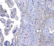 CD44 Antibody Placenta IHC. Immunohistochemistry analysis of CD44 / CD44 antigen expression in FFPE human placental tissue using rabbit polyclonal antibody at 1 ug/ml. Membranous HRP-DAB brown staining is observed in trophoblast and stromal-associated cells, highlighting cell surface localization consistent with CD44 expression. The staining pattern demonstrates regional variation between villous structures and stromal compartments and supports its use for evaluating CD44 distribution and cellular organization in placental tissue. Heat induced epitope retrieval was performed by steaming tissue sections in pH 6 citrate buffer for 20 min followed by cooling prior to testing.
