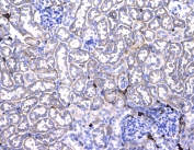 CD44 Antibody Mouse Kidney IHC. Immunohistochemistry analysis of CD44 / CD44 antigen expression in FFPE mouse kidney tissue using rabbit polyclonal antibody at 1 ug/ml. Membranous HRP-DAB brown staining is observed in tubular epithelial cells and along vascular-associated structures, highlighting cell surface localization consistent with CD44 expression. The staining pattern demonstrates widespread distribution across renal tubules with additional signal in interstitial regions, supporting its use for evaluating CD44 expression and cellular organization in kidney tissue. Heat induced epitope retrieval was performed by steaming tissue sections in pH 6 citrate buffer for 20 min followed by cooling prior to testing.