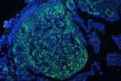 GNB1 Antibody Mouse Lymph Tissue IF. Immunofluorescence analysis of GNB1 expression in FFPE mouse lymph tissue using antibody at 1 ug/ml (green) with DAPI nuclear stain (blue). Diffuse cytoplasmic and membrane-associated fluorescence is observed throughout lymphoid cell populations, highlighting widespread GNB1 expression within the tissue. The staining pattern demonstrates dense cellular distribution consistent with lymphoid architecture and supports its use for visualizing GNB1 localization in immune cell-rich environments. Heat induced epitope retrieval was performed by steaming tissue sections in pH 6 citrate buffer for 20 min.