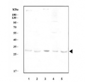 IL6 Antibody Spleen and Macrophage Cell Line WB. Western blot analysis of 1) rat spleen, 2) mouse spleen, 3) mouse ANA-1, 4) mouse RAW264.7, and 5) mouse EL-4 cell lysates using IL6 Antibody / Interleukin-6 Antibody demonstrates a distinct band at approximately 24 kDa across multiple immune-related tissues and cell lines, consistent with the expected molecular weight of Interleukin 6. IL6 is a key pro-inflammatory cytokine produced by activated immune cells and plays an important role in cytokine signaling, innate immune responses, lymphocyte activation, and regulation of inflammatory microenvironments. Detection in splenic tissue and established immune cell models supports the utility of this antibody for studies of inflammation, immunology, cytokine biology, and immune-mediated disease mechanisms. Predicted molecular weight: ~24 kDa, though higher molecular weight forms may be observed due to glycosylation.