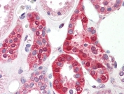 IHC testing of FFPE human kidney tissue with SLC6A8 antibody at 5ug/ml. Required HIER: steamed antigen retrieval with pH6 citrate buffer; AP-staining.