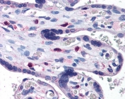 IHC testing of FFPE human placental tissue with SNX16 antibody at 3.75ug/ml. Required HIER: steamed antigen retrieval with pH6 citrate buffer; AP-staining.