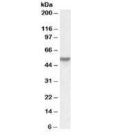 Vitamin D-binding protein Antibody Lung WB. Western blot testing of lung lysate with Vitamin D-binding protein antibody at 0.03ug/ml. Predicted molecular weight: ~53kDa.