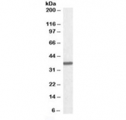 Western blot analysis of Arginase 1 Antibody Goat Polyclonal. Human liver lysate was probed with the goat polyclonal Arginase 1 antibody at 0.01ug/ml. Lane 1: human liver lysate. A band is detected at approximately 35 kDa, consistent with the predicted molecular weight of Arginase-1 (ARG1), a cytosolic urea cycle enzyme highly expressed in hepatocytes and responsible for the conversion of L-arginine to urea and ornithine in liver metabolism.