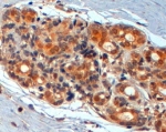IHC staining of FFPE human breast with WNT3A antibody at 2ug/ml. HIER: steamed with pH6 citrate buffer, HRP-staining.