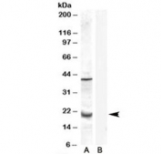 Western blot testing of human prostate lysate with GPX7 antibody at 0.3ug/ml with [B] and without [A] blocking/immunizing peptide. The expected ~20 kDa band and the additional ~40 kDa band are both blocked by the immunizing peptide.