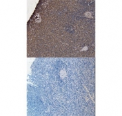 IHC staining of FFPE human tonsil with CD20 antibody at 7ug/ml. HIER: steamed with pH6 citrate buffer, HRP-staining.