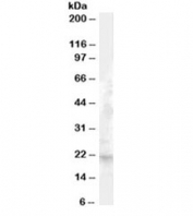 FGF21 Antibody Liver WB. Western blot testing of human liver lysate with FGF21 antibody at 1ug/ml. Predicted molecular weight ~21 kDa.