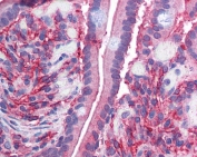 IHC testing of FFPE human small intestine tissue with CYBRD1 antibody at 2.5ug/ml. HIER: steamed with pH6 citrate buffer, AP-staining.
