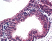 IHC testing of FFPE human prostate tissue with AKT3 antibody at 5ug/ml. Required HIER: steamed antigen retrieval with pH6 citrate buffer; AP-staining.