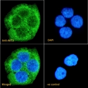 IF/ICC staining of fixed and permeabilized human A431 cells with AKT3 antibody (green) at 10ug/ml and DAPI nuclear stain (blue).