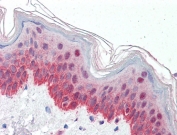 IHC testing of FFPE human skin with P4HA1 antibody at 5ug/ml. Required HIER: steamed antigen retrieval with pH6 citrate buffer; AP-staining.