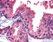 IHC testing of FFPE human prostate tissue with PDE4B antibody at 5ug/ml. Required HIER: steamed antigen retrieval with pH6 citrate buffer; AP-staining.