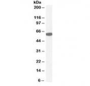 Catalase Antibody / Hydrogen Peroxide Detoxification Enzyme WB. Western blot analysis of human kidney lysate using Catalase Antibody / Hydrogen Peroxide Detoxification Enzyme at 1 ug/ml. A distinct immunoreactive band is detected at approximately 60 kDa, consistent with the predicted molecular weight of catalase, supporting specific detection of the endogenous antioxidant enzyme in human kidney tissue.