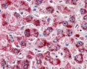 Catalase Antibody / Hydrogen Peroxide Detoxification Enzyme Human Liver IHC. Immunohistochemical staining of FFPE human liver tissue using Catalase Antibody / Hydrogen Peroxide Detoxification Enzyme at 2 ug/ml. Catalase expression is detected predominantly within the cytoplasm of hepatocytes, consistent with its localization in peroxisomes and its essential role in hydrogen peroxide detoxification and maintenance of cellular redox homeostasis. Heat-induced epitope retrieval was performed by steaming sections in pH 6 citrate buffer prior to AP-based immunostaining.