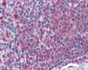 Catalase Antibody / Hydrogen Peroxide Detoxification Enzyme Human Spleen IHC. Immunohistochemical staining of FFPE human spleen tissue using Catalase Antibody / Hydrogen Peroxide Detoxification Enzyme at 2 ug/ml. Catalase expression is detected predominantly within the cytoplasm of splenic lymphoid cells, consistent with its role in protecting immune cells from oxidative stress through the detoxification of hydrogen peroxide. Heat-induced epitope retrieval was performed by steaming sections in pH 6 citrate buffer prior to AP-based immunostaining.