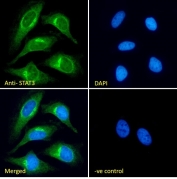 Immunofluorescent staining of fixed and permeabilized human HeLa cells with STAT3 antibody (green) at 10ug/ml and DAPI nuclear stain (blue).