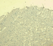 Negative control: IHC staining of FFPE human liver tissue without primary antibody. HIER: steamed with pH6 citrate buffer, HRP-staining.
