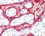 IHC testing of FFPE human placental tissue with HSD3B1 antibody at 3.75ug/ml. Required HIER: steamed antigen retrieval with pH6 citrate buffer; AP-staining.