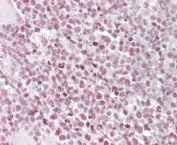 IKZF1 Antibody Human Tonsil AP-IHC. Immunohistochemical staining of FFPE human tonsil tissue using IKZF1 Antibody demonstrates prominent nuclear AP-red staining within subsets of lymphoid cells. The staining pattern is consistent with expression of IKZF1 (Ikaros Family Zinc Finger 1), a DNA-binding transcription factor that functions as a master regulator of lymphoid development, hematopoietic differentiation, and immune cell lineage commitment. Strong nuclear immunoreactivity is expected for this transcriptional regulator and highlights its essential role in controlling gene expression programs required for normal lymphocyte maturation and immune system function. HIER: steamed in pH 6 citrate buffer prior to staining. Detection was performed using an alkaline phosphatase (AP) chromogenic method.