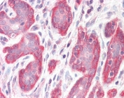 IHC testing of FFPE human breast tissue with PDLIM4 antibody. Required HIER: steamed antigen retrieval with pH6 citrate buffer; AP-staining.