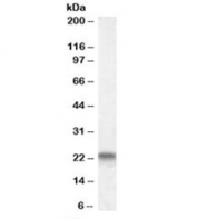 Western blot testing of human heart lysate with CAV3 antibody at 0.3ug/ml. Predicted molecular weight: ~17 kDa but routinely observed at 20~25 kDa.