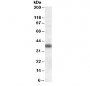 Clu Antibody Rat Brain WB. Western blot testing of rat brain lysate with Clu antibody at 0.3ug/ml. Predicted molecular weight: 75-80 kDa (heterodimer precursor), 36-39 kDa (alpha subunit), 34-36 kDa (beta subunit).